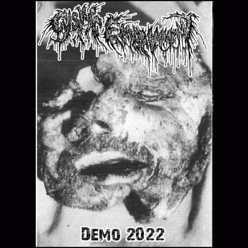Cystic Embalment : Demo 2022